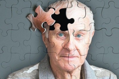 Gelecekte Alzheimer  Olmak İstemiyorsanız Bir An Önce Yapmanız Gerekenler