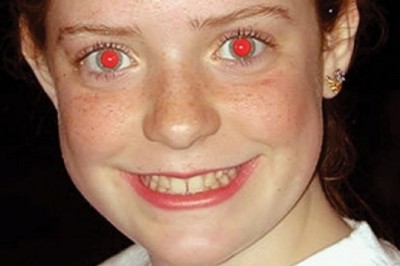 Neden Flaş Patlayınca Gözlerimiz Kırmızı Çıkar?