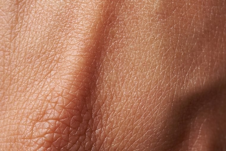 Et Benleri, Deri Deriye Sürtününce Çıkar