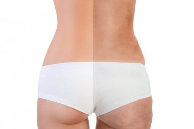 Dar Kıyafetleri Bir Kenara Atma Vakti!