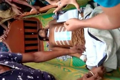 Hastaneye Gitti Tüm İç Organları Çalındı!